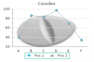 casodex 50 mg order overnight delivery