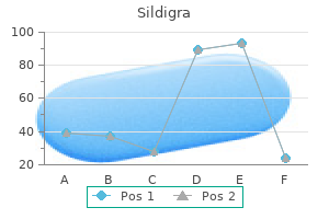 buy sildigra 100 mg overnight delivery