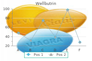 wellbutrin 300 mg order without prescription
